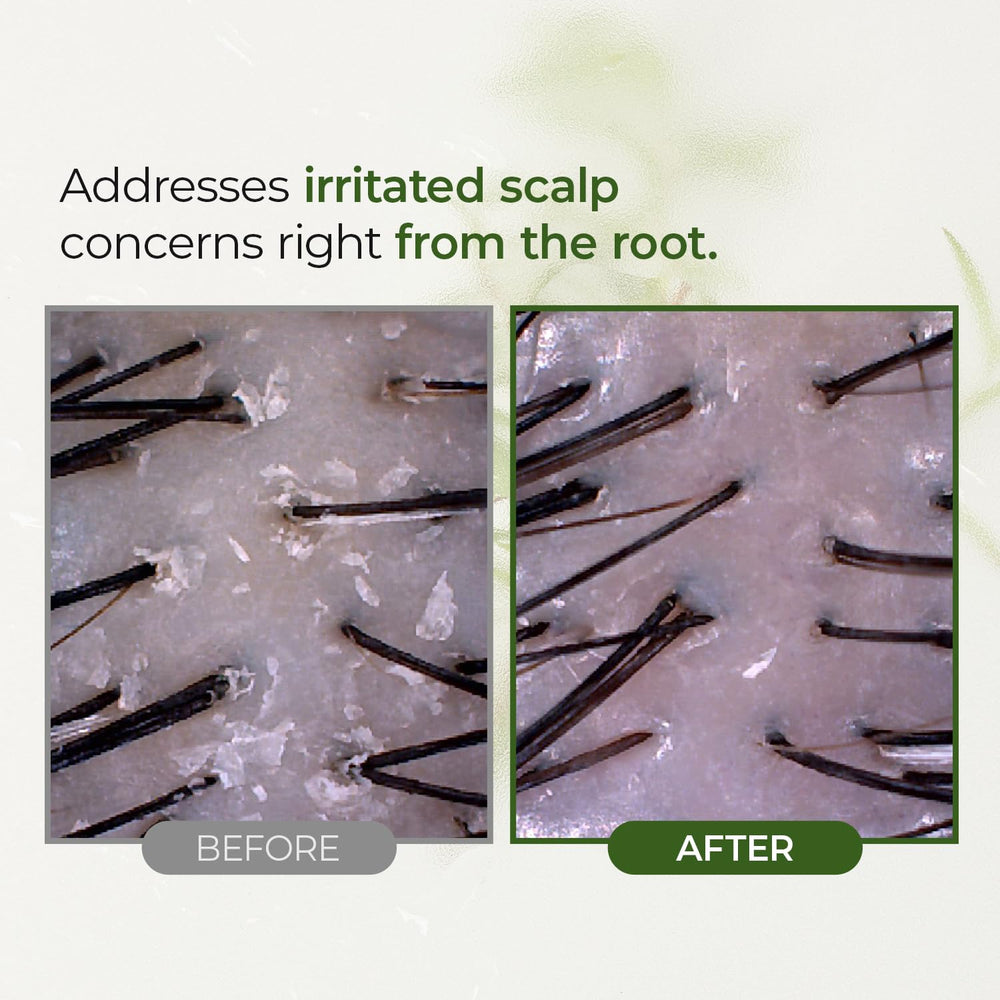 Steambase Tea Tree Scalp Water Scaler in a bathroom setup.