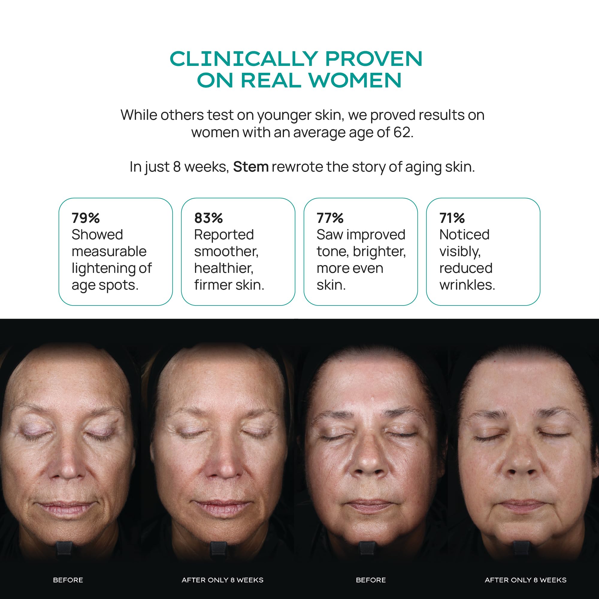 STEM Natural Intelligence plant stem cell technology dropper for daily regeneration routine.