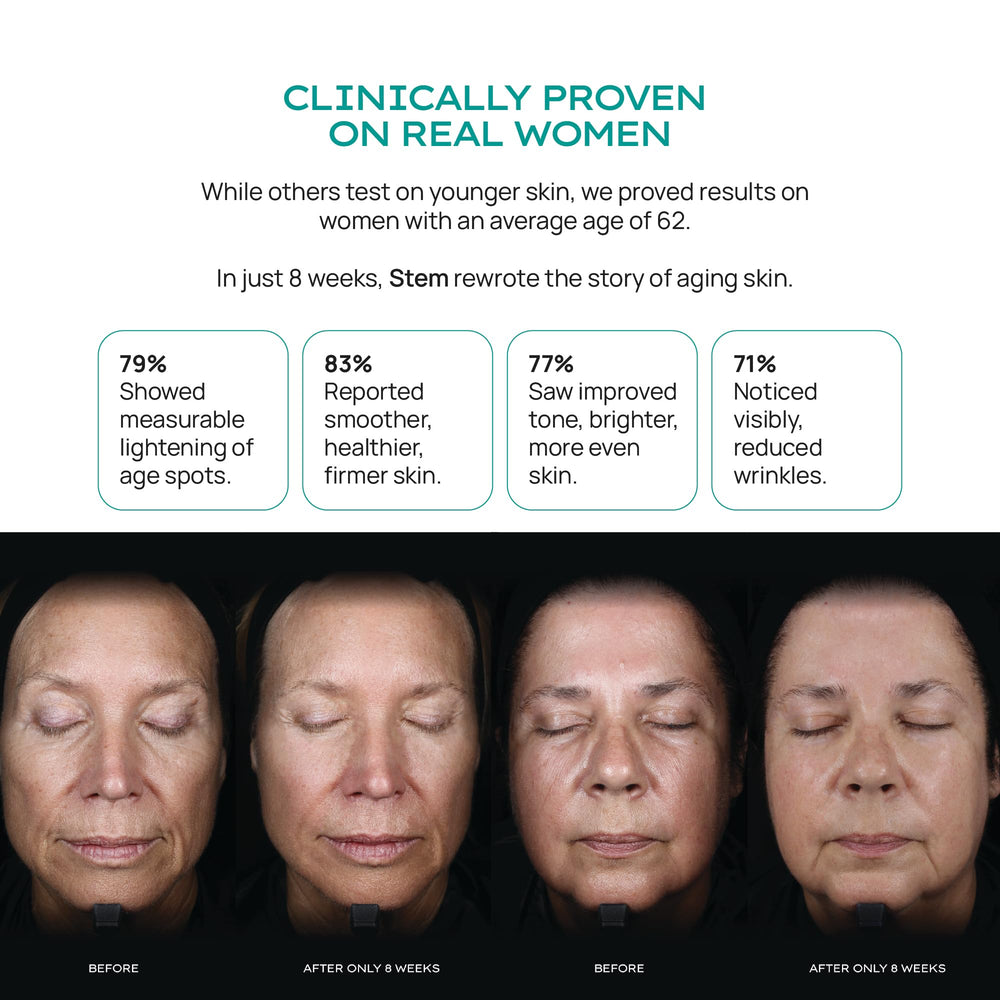 STEM Natural Intelligence plant stem cell technology dropper for daily regeneration routine.