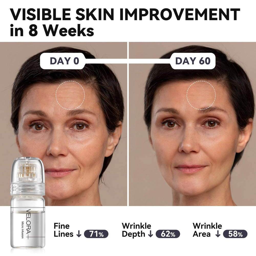 Styirl packaging showing a one-month supply with two serums and two stamps.
