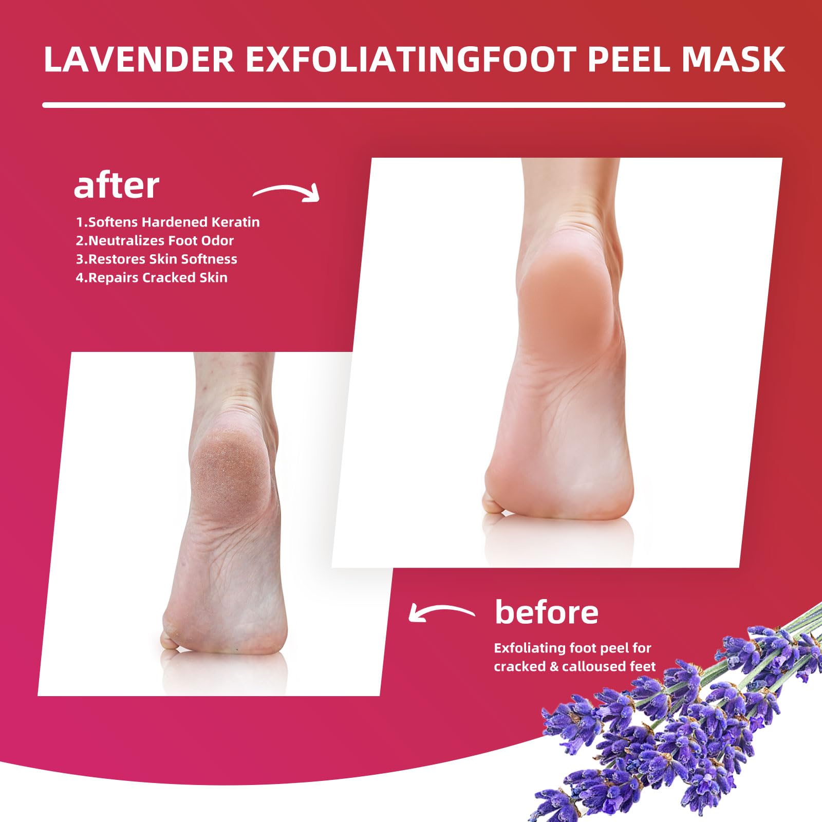 Sumetact Foot Peel Mask close-up soles highlights dead skin removal potential.
