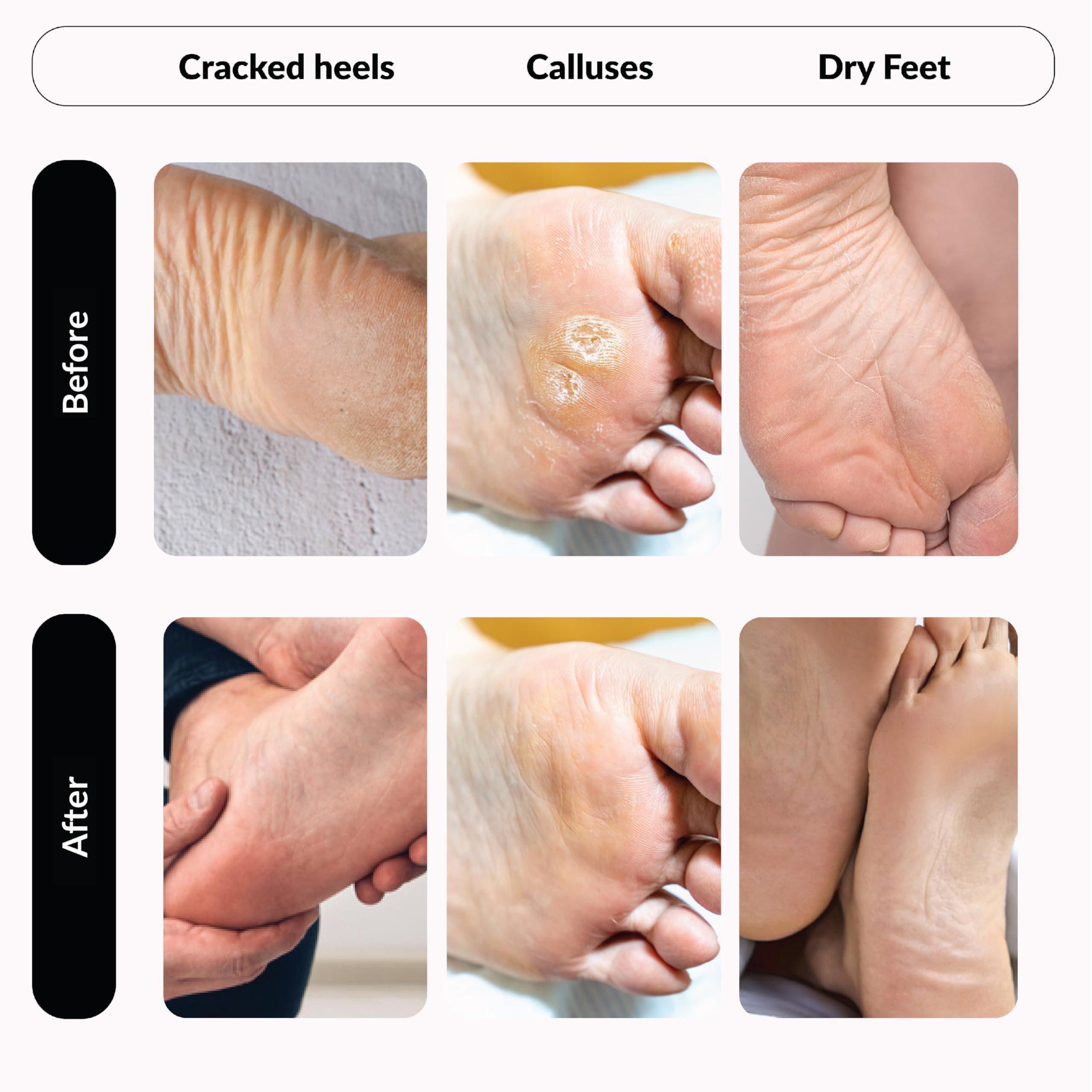 Summer Foot cruelty-free and mineral oil-free formula label on packaging.