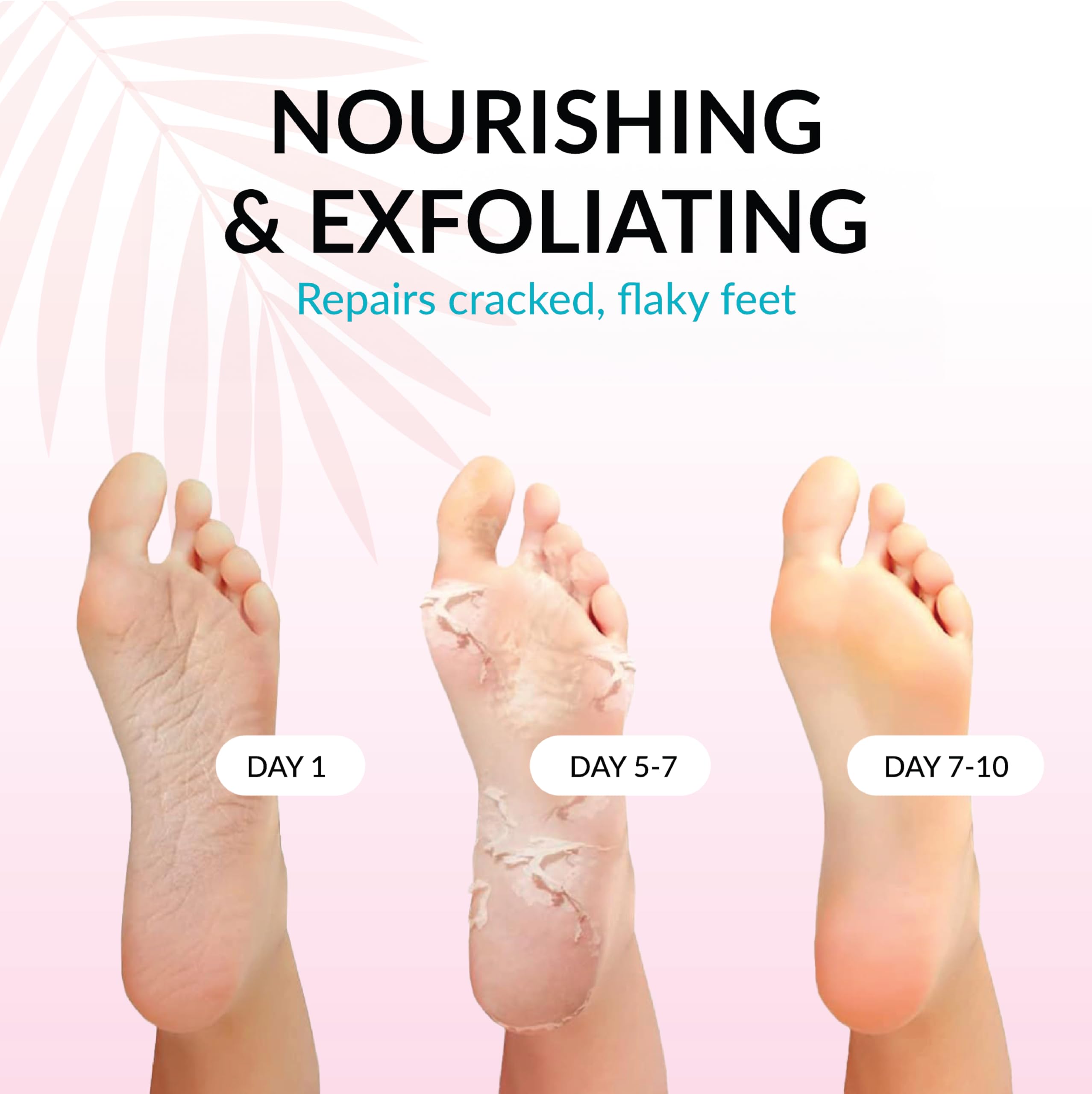 Summer Foot before-after: rough heels transition to softer skin.