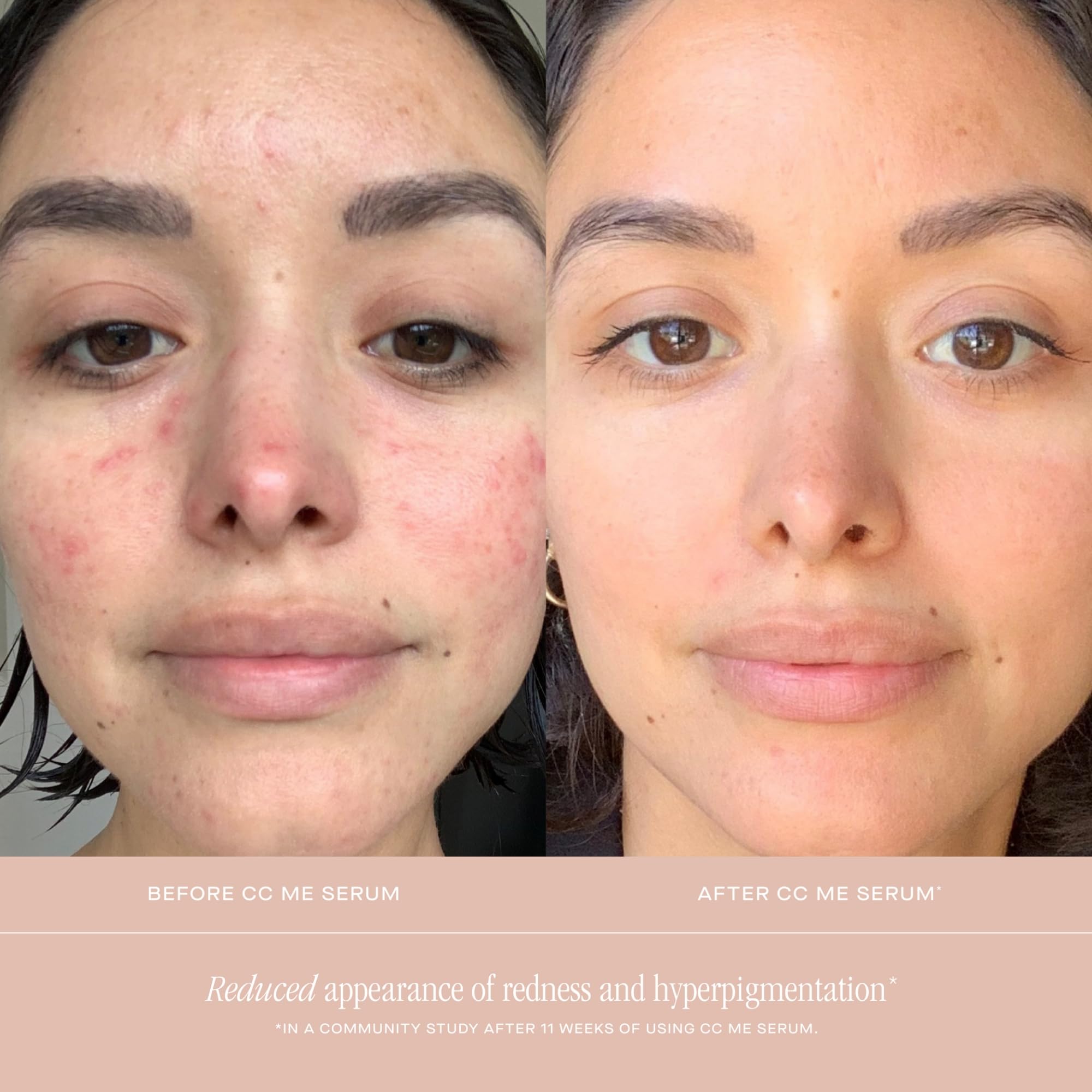 Summer Fridays CC Me Serum on skin close-up showing radiance