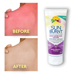 SunBurnt Advanced After-Sun Lotion texture shows a light, non-greasy finish.