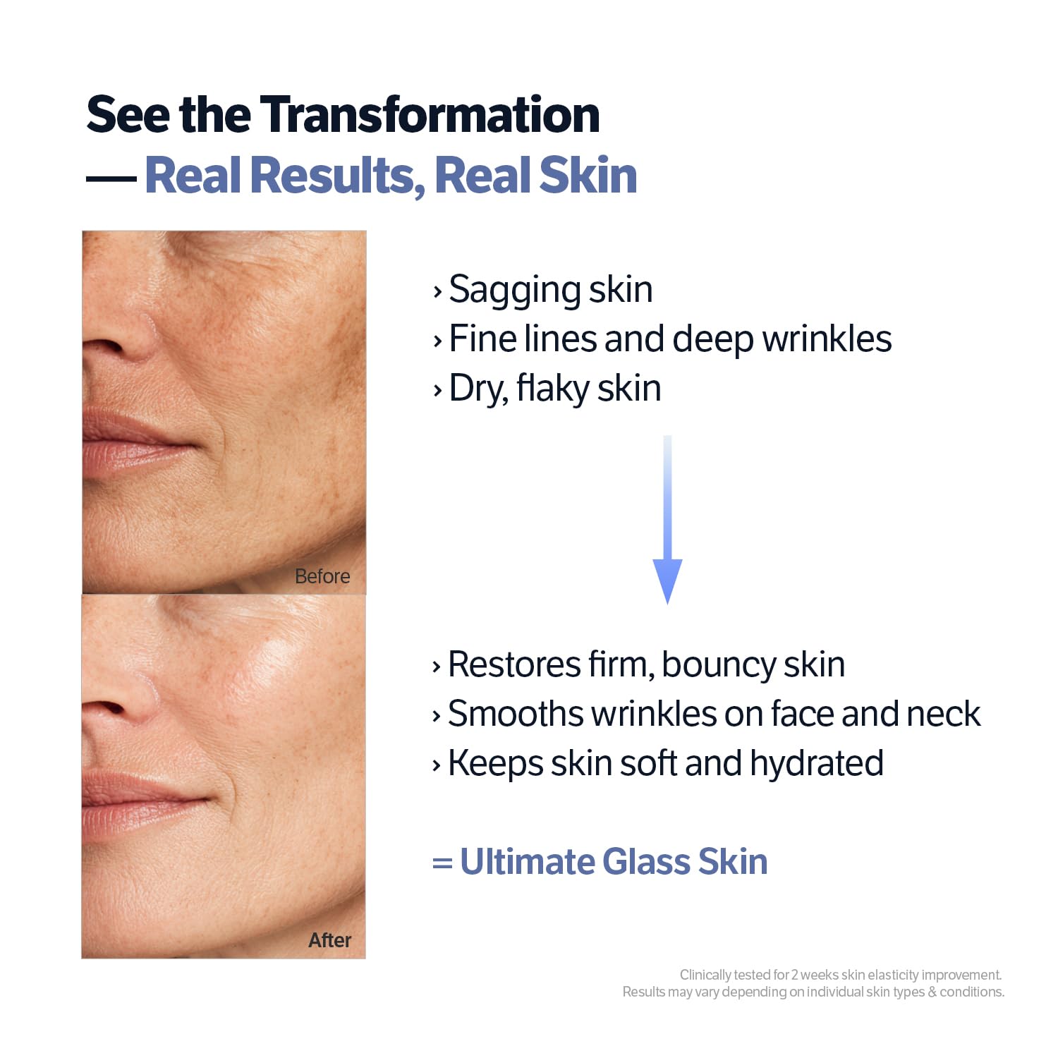 SUNGBOON EDITOR smoothing fine lines for a firmer look