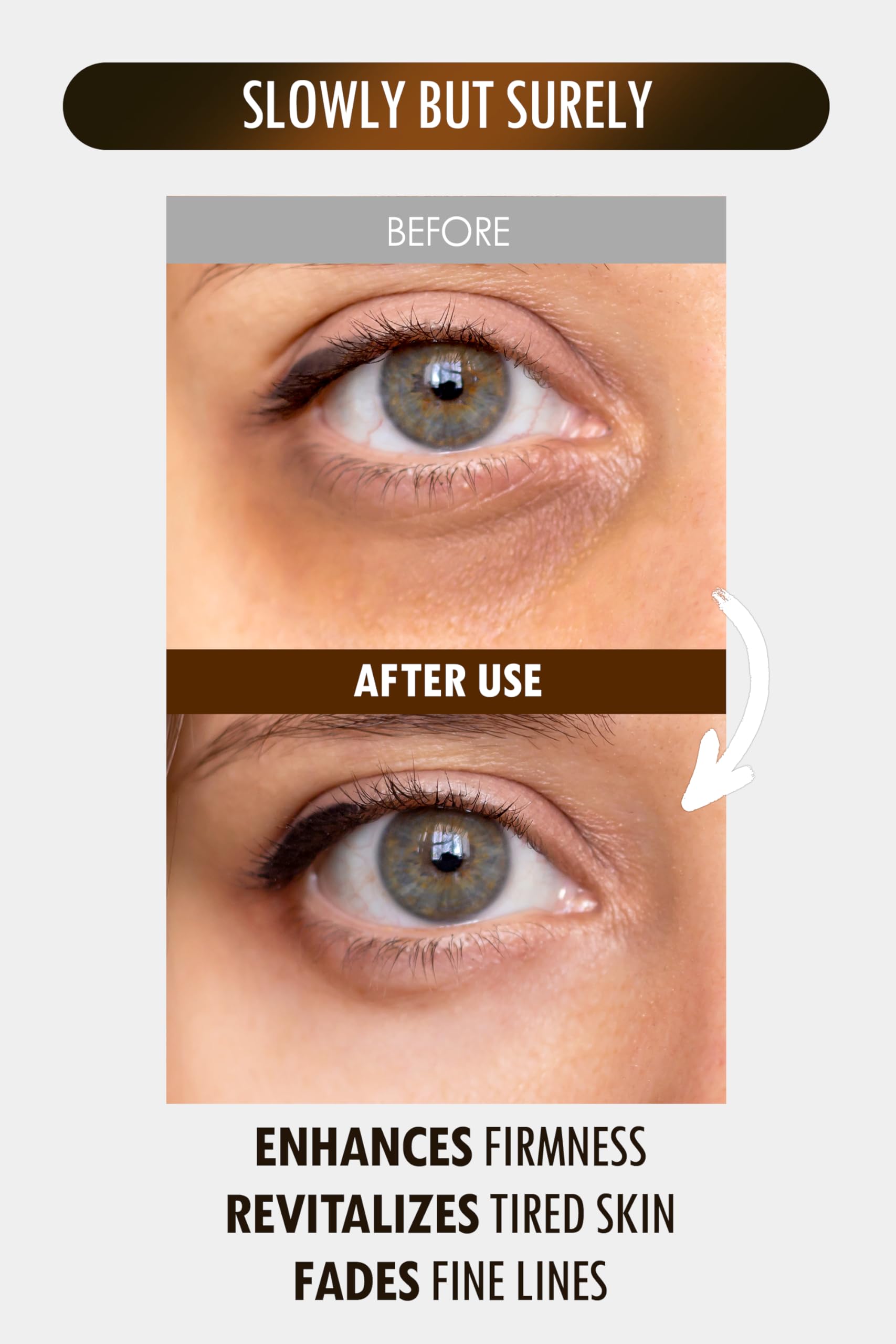 SUR.MEDIC+ 24K Gold Perfection hyaluronic acid reveals multi-layer hydration.