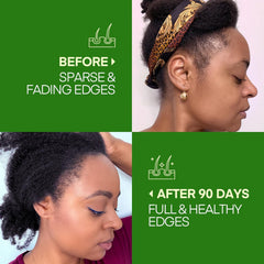 Svvimer Batana Oil being applied for scalp nourishment and shine.