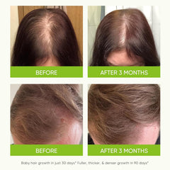 Svvimer hair growth serum spray bottle in use for even application.