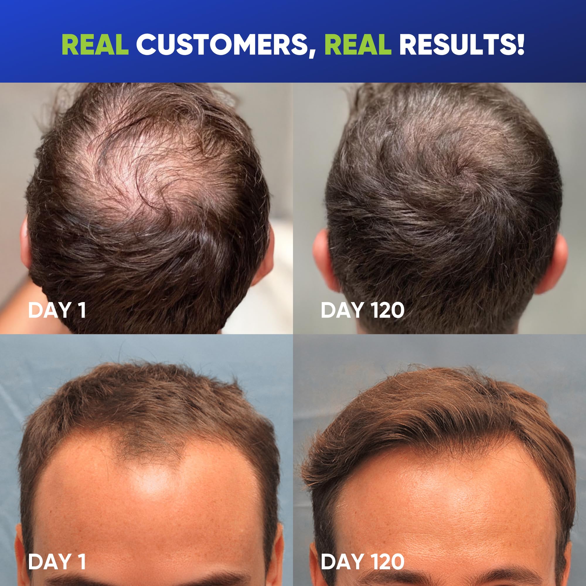 Rich lather from Svvimer shampoo demonstrates cleansing action for scalp refreshment.
