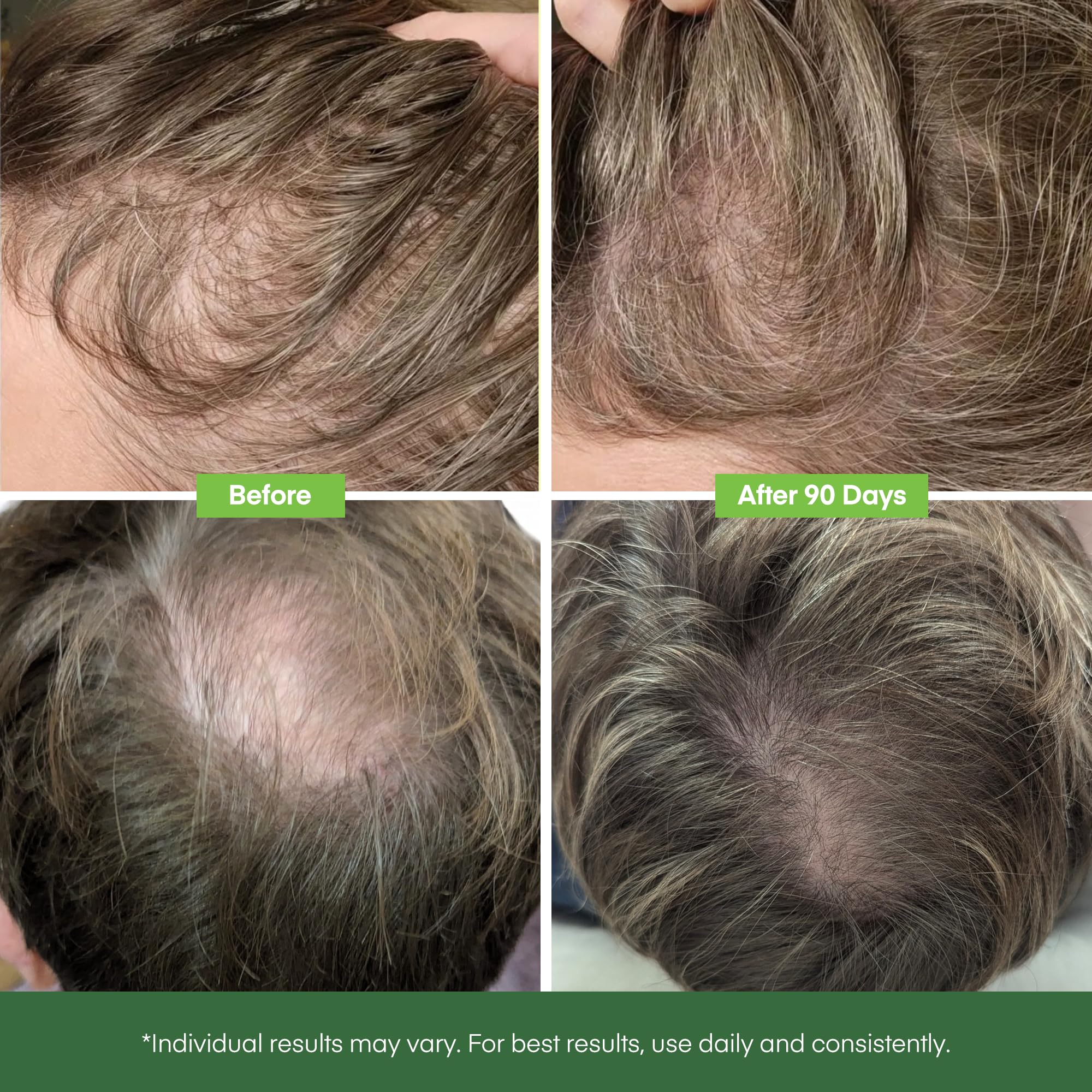 Svvimer rosemary oil ingredient highlighting natural scalp nourishment.