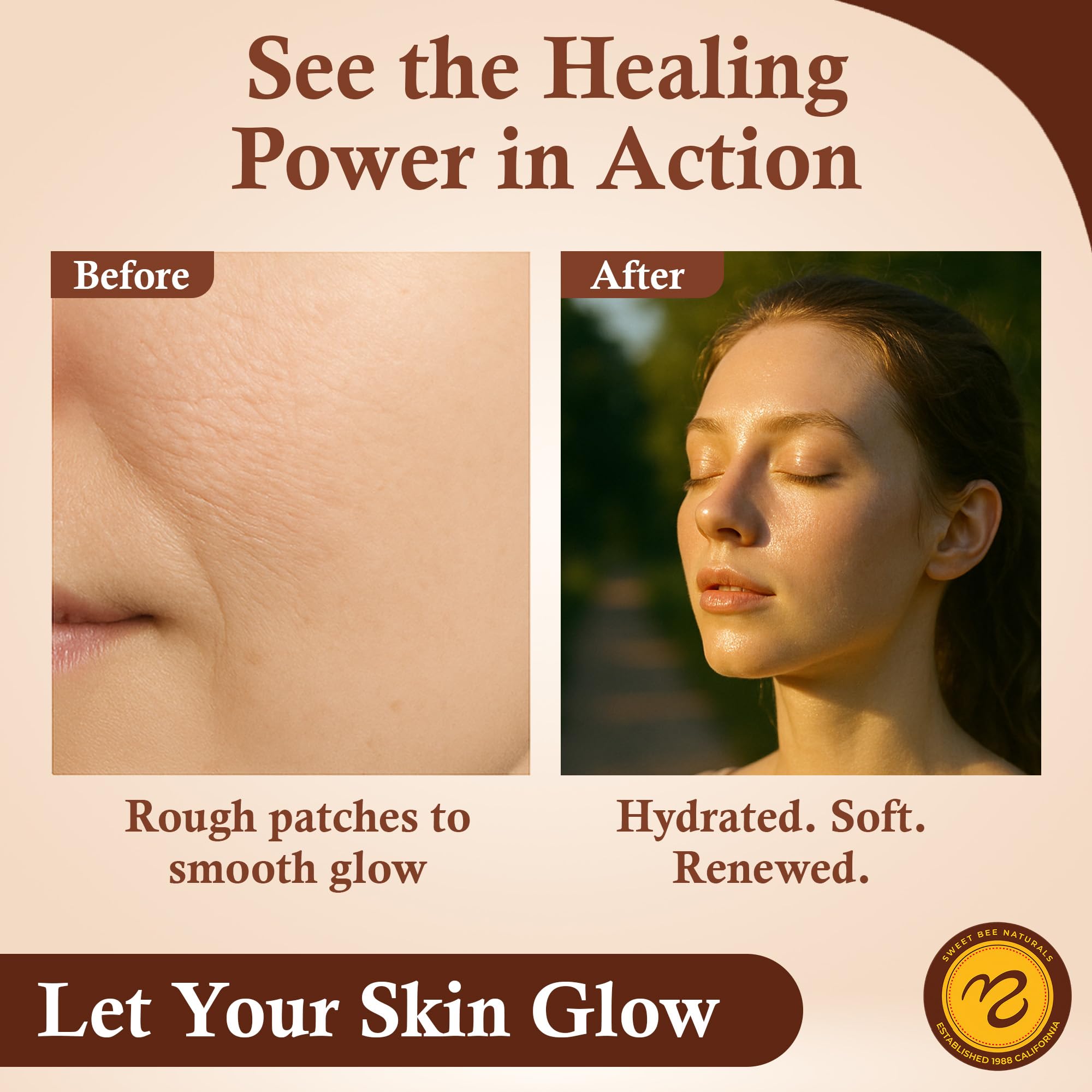 Sweet Bee Naturals balm on dry skin delivers soothing moisture