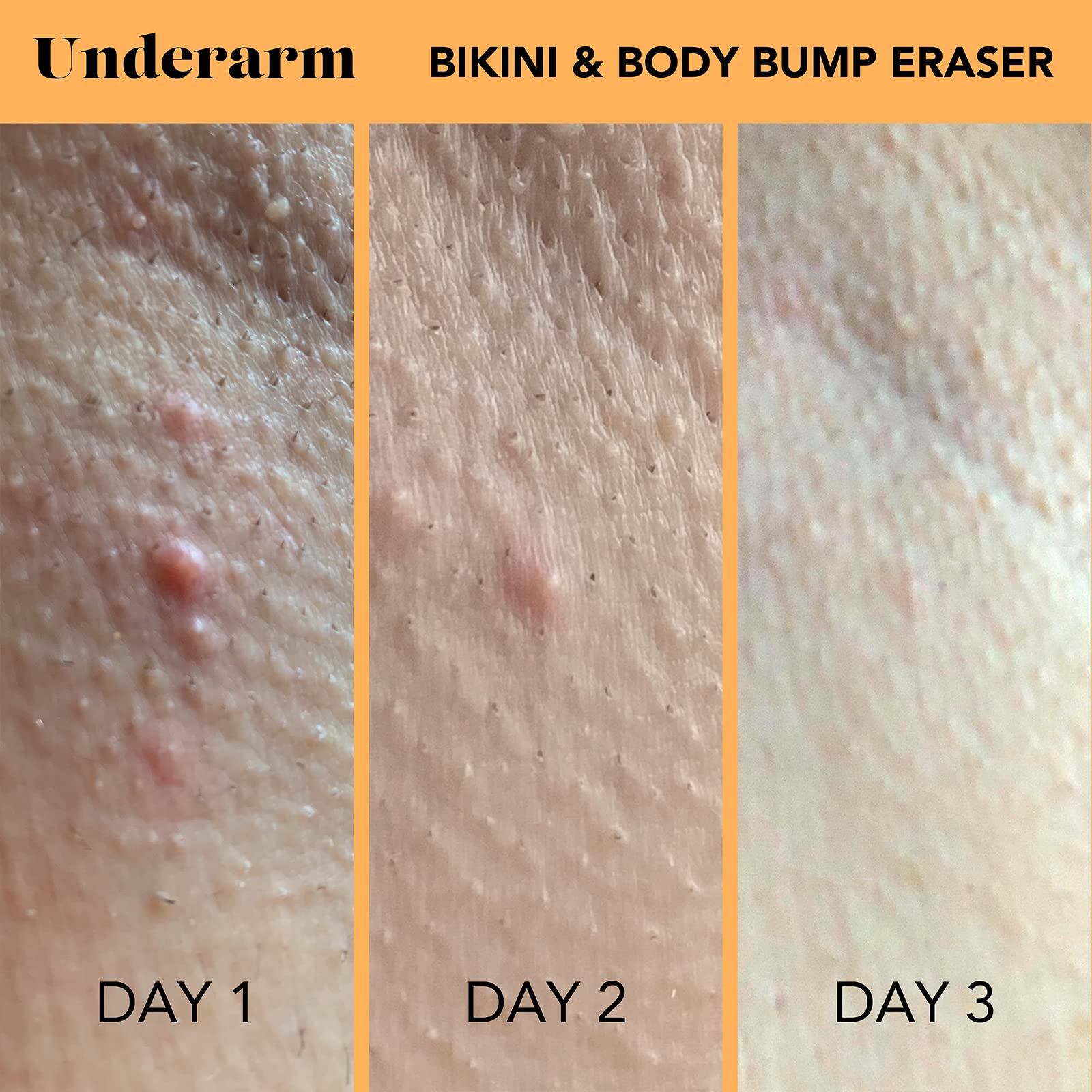 SweetSpot Labs Bump Eraser application shot showing smooth rub-in.