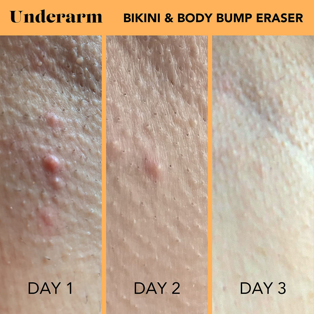 SweetSpot Labs Bump Eraser application shot showing smooth rub-in.