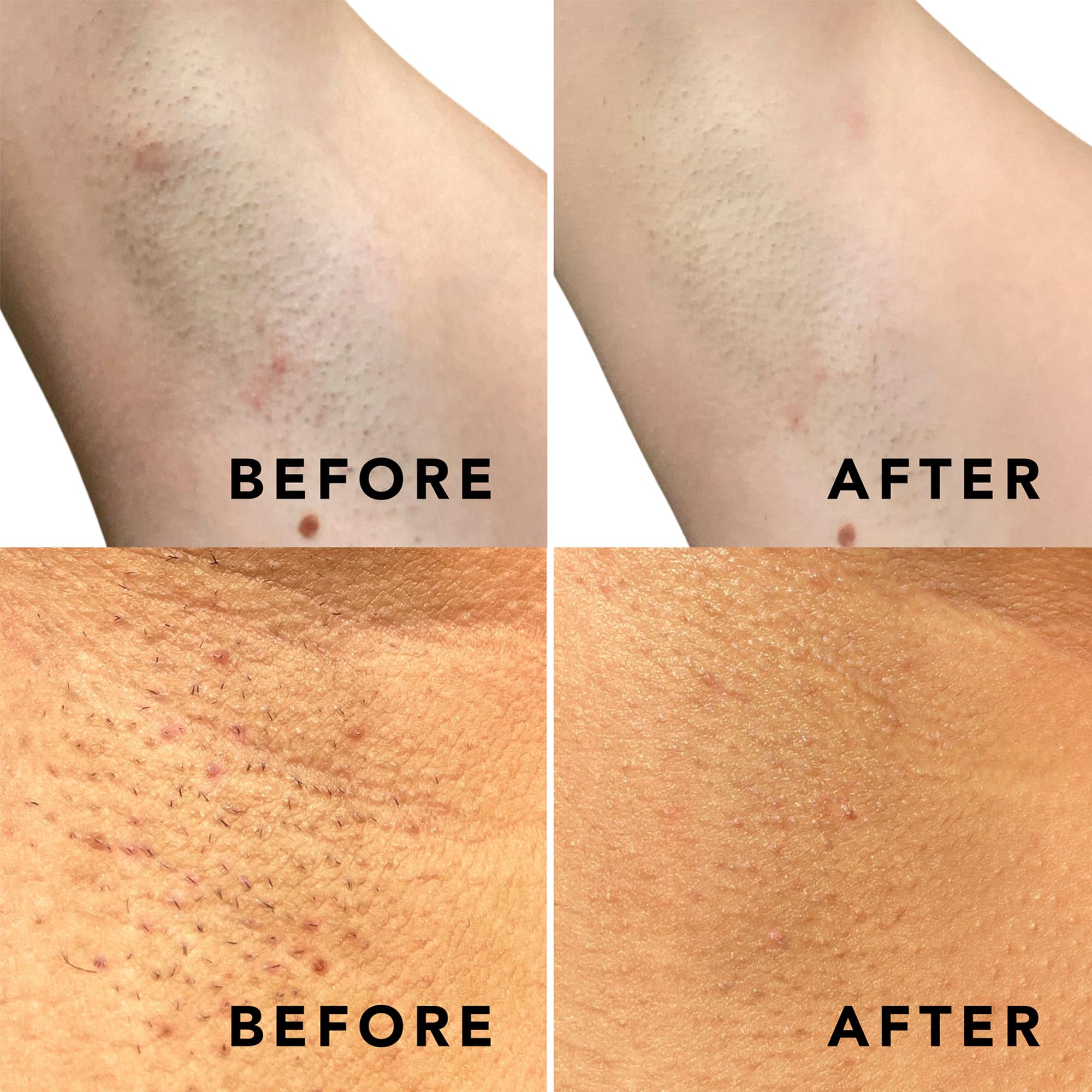 Niacinamide and witch hazel visible in SweetSpot Labs formula for soothing support.
