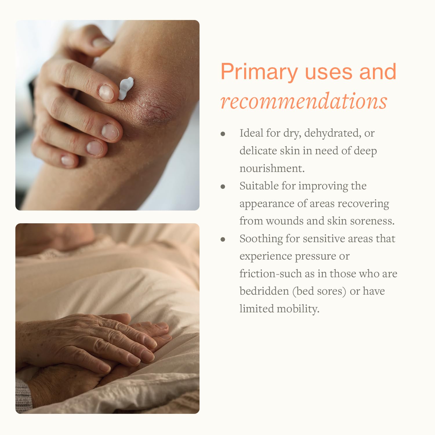 SwissJust Cream applied on irritated skin highlighting marigold benefits.