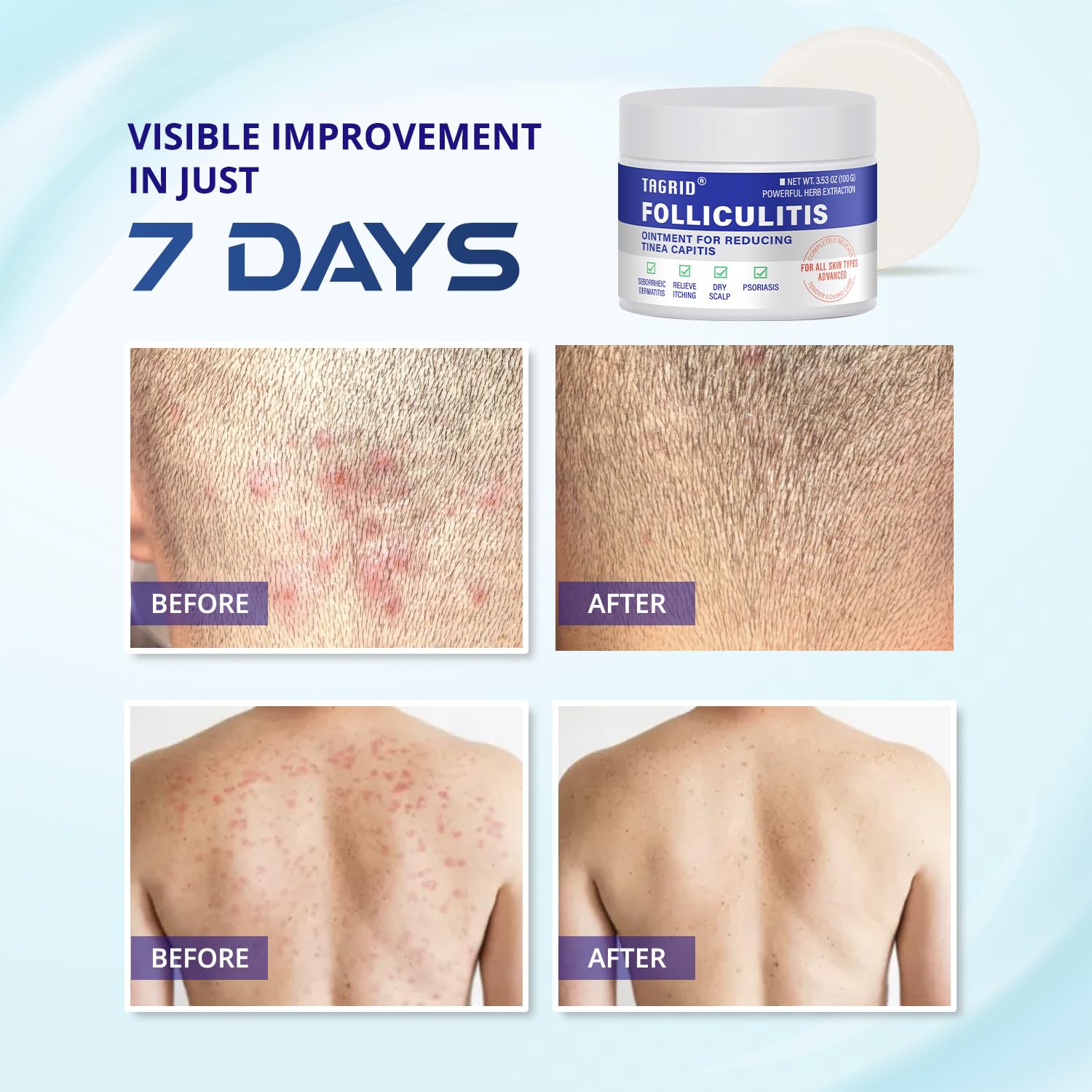 Tagrid cream used on face and body for daily soothing care.