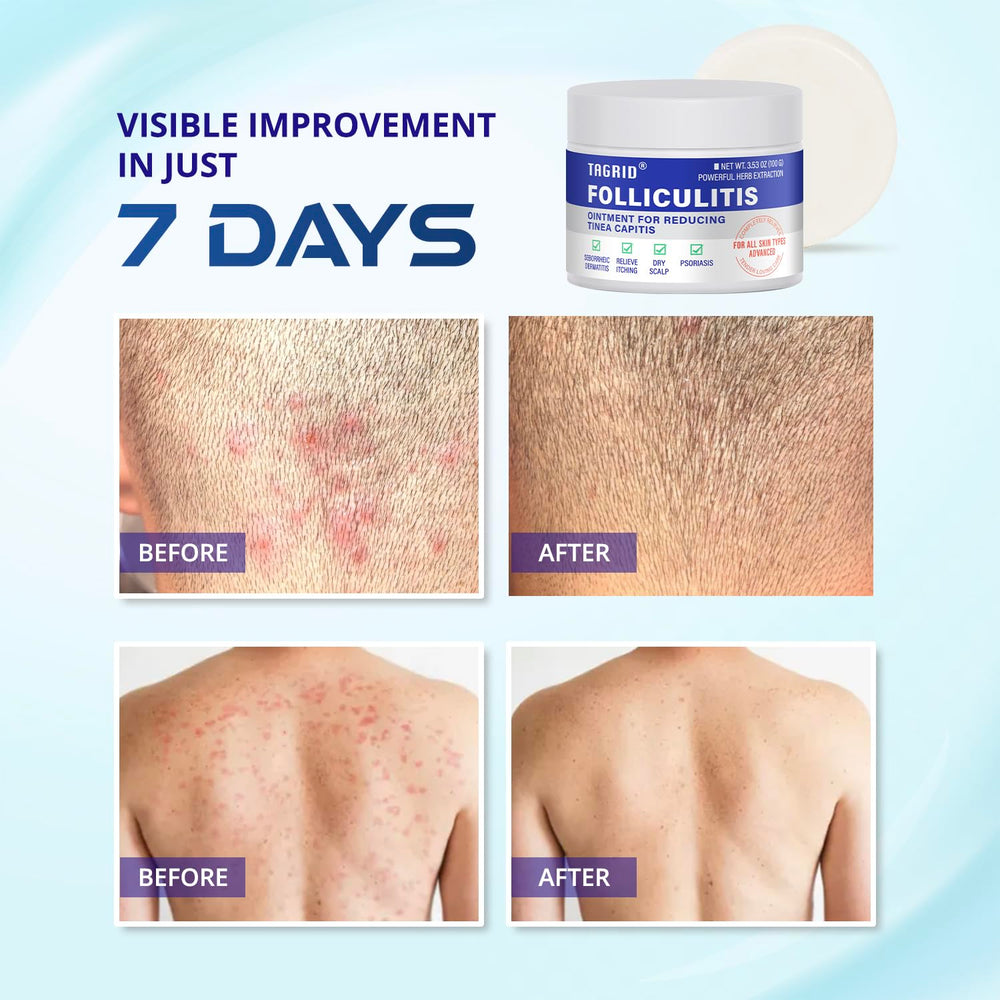 Tagrid cream used on face and body for daily soothing care.