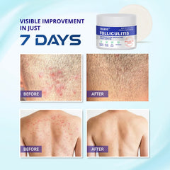 Tagrid cream used on face and body for daily soothing care.