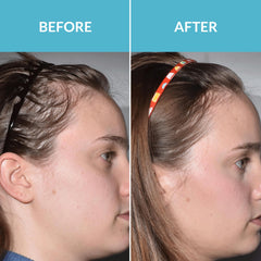 Talika Hair Force Phyto Serum on towel-dried hair adds vitality and shine.