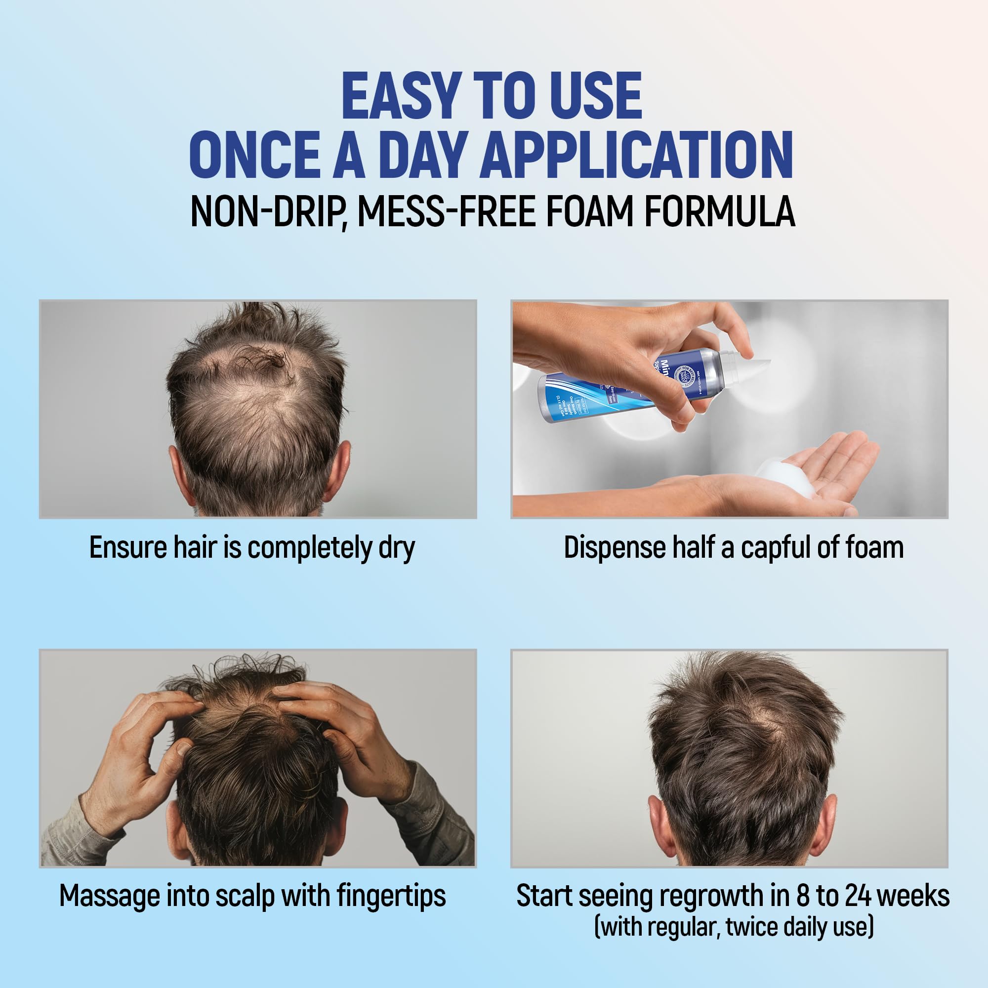 Dispensing action of TARO 5% foam allows precise dosing