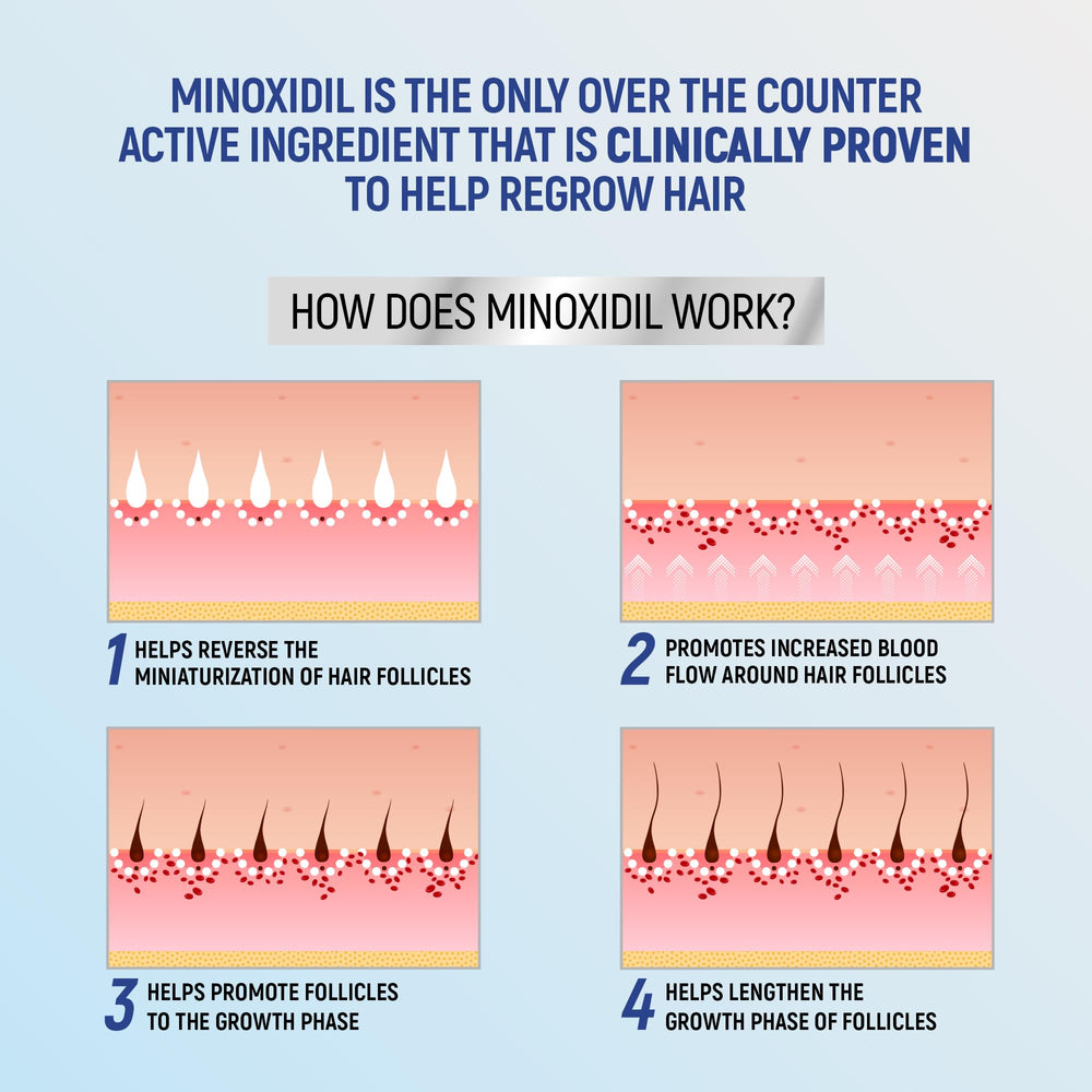 Hands apply TARO foam on scalp for even coverage