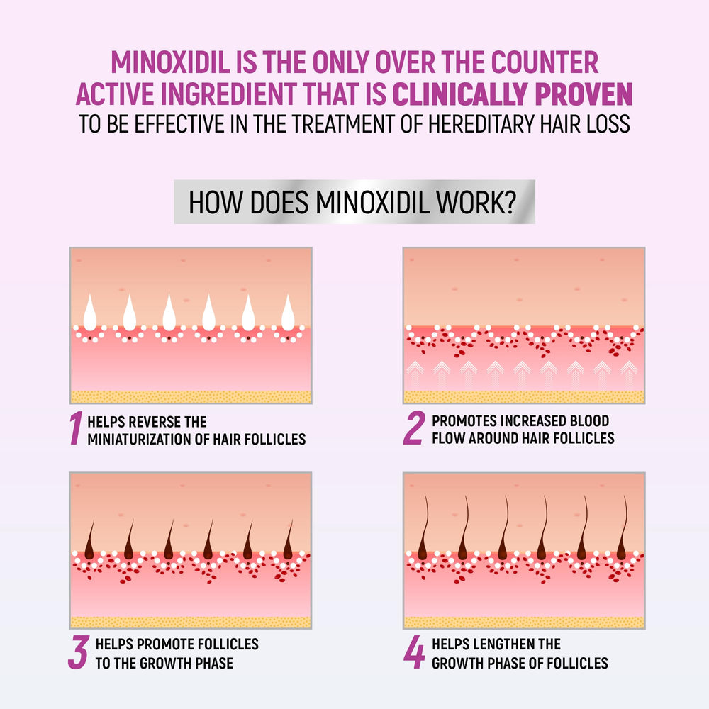 Foam on scalp using TARO Minoxidil supports simple daily application.