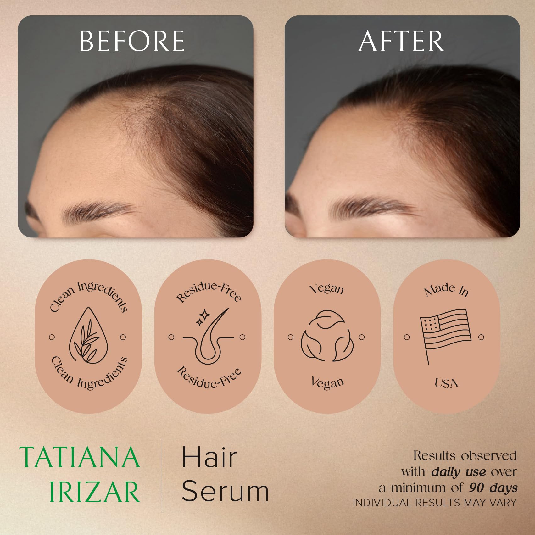 Tatiana Irizar-hair-growth-appearance image hints fuller look over time