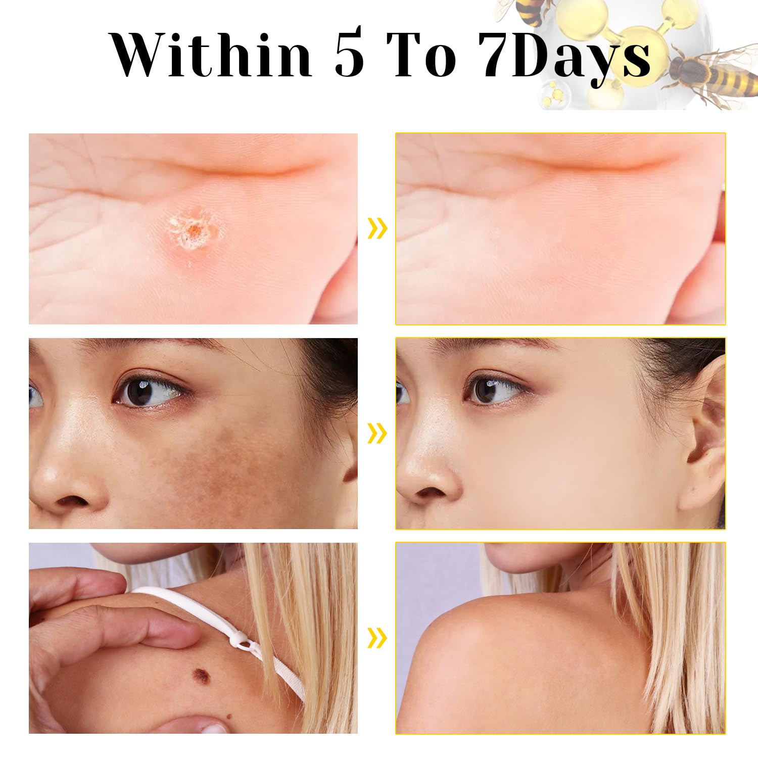 TDBFD Bee Venom Comprehensive Cream ingredients reveal natural extracts that nourish skin.