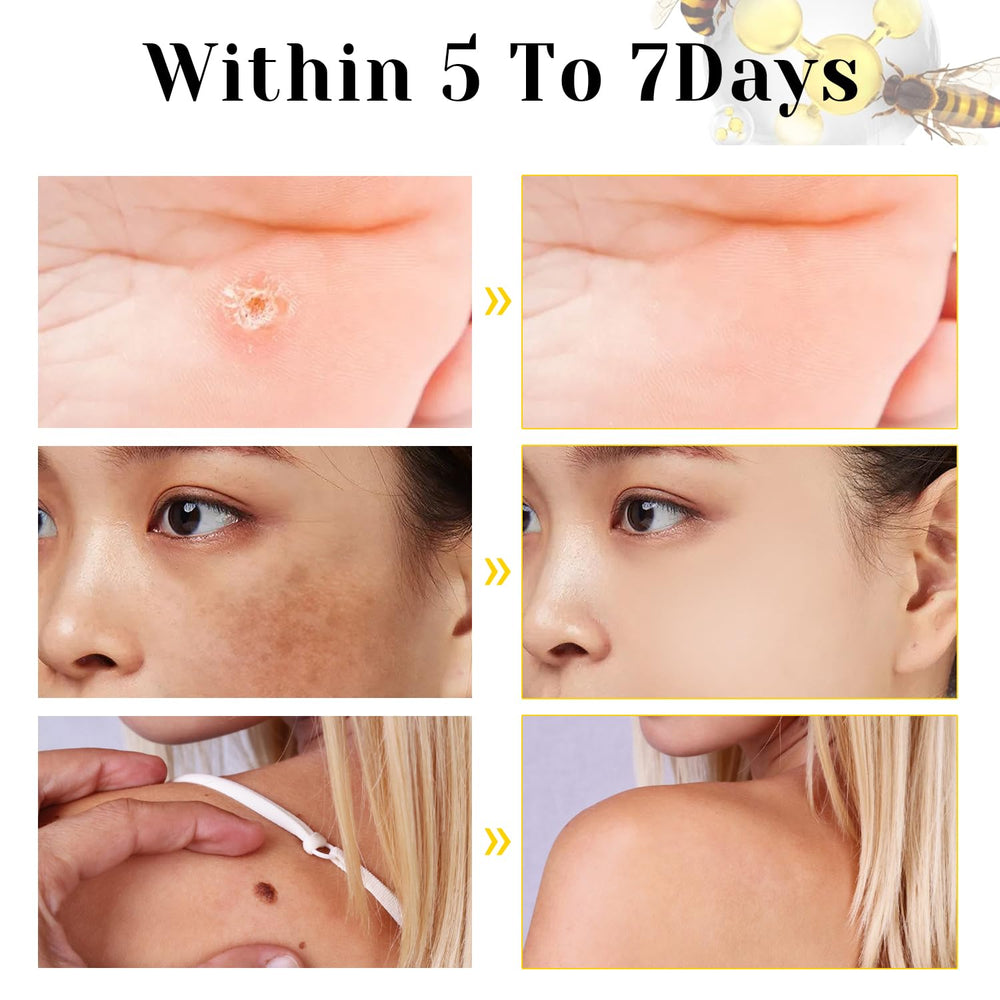 TDBFD Bee Venom Comprehensive Cream ingredients reveal natural extracts that nourish skin.