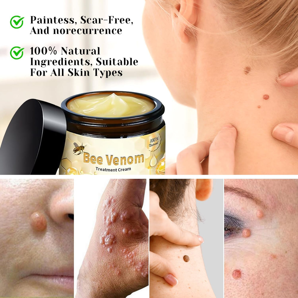TDBFD Bee Venom Comprehensive Cream natural formula suitable for sensitive skin.