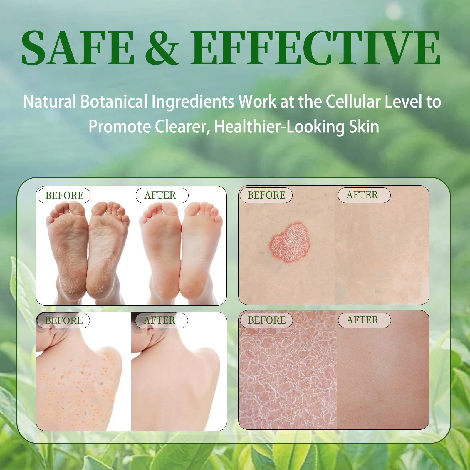 Tea Tree Soap for face and body use in daily routine.