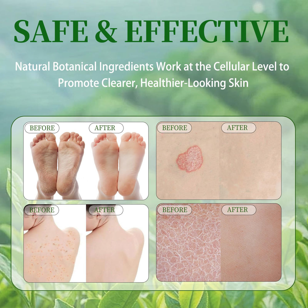 Tea Tree Soap for face and body use in daily routine.
