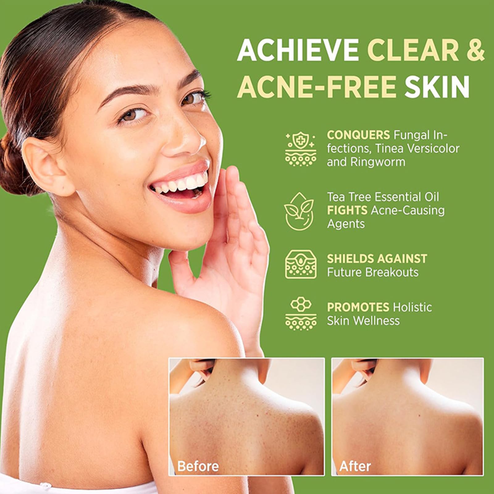 Tea Tree Soap relief bar natural exfoliation promotes brighter, smoother skin.
