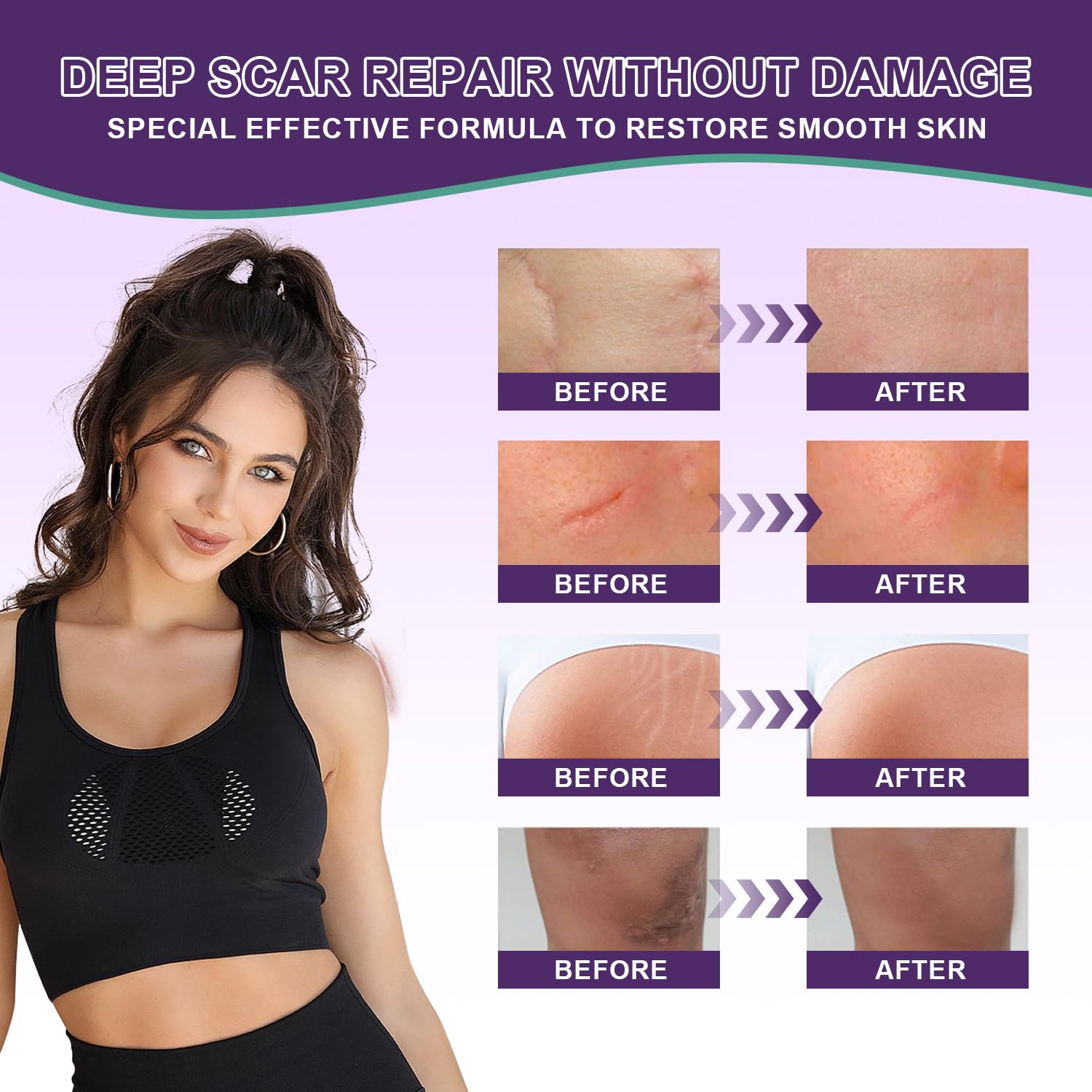 Tearich silicone scar cream bottle packaging for convenient daily use