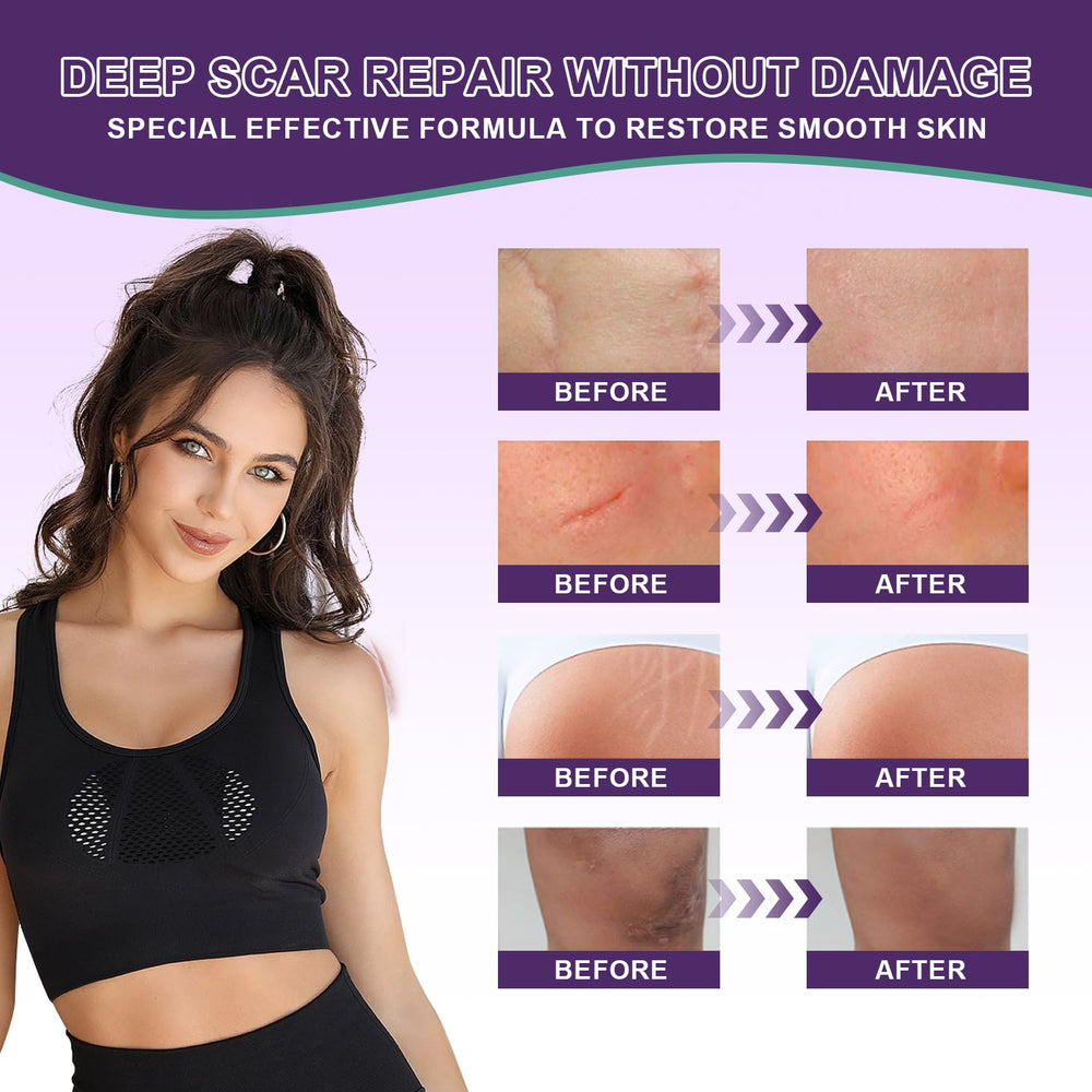 Tearich silicone scar cream bottle packaging for convenient daily use