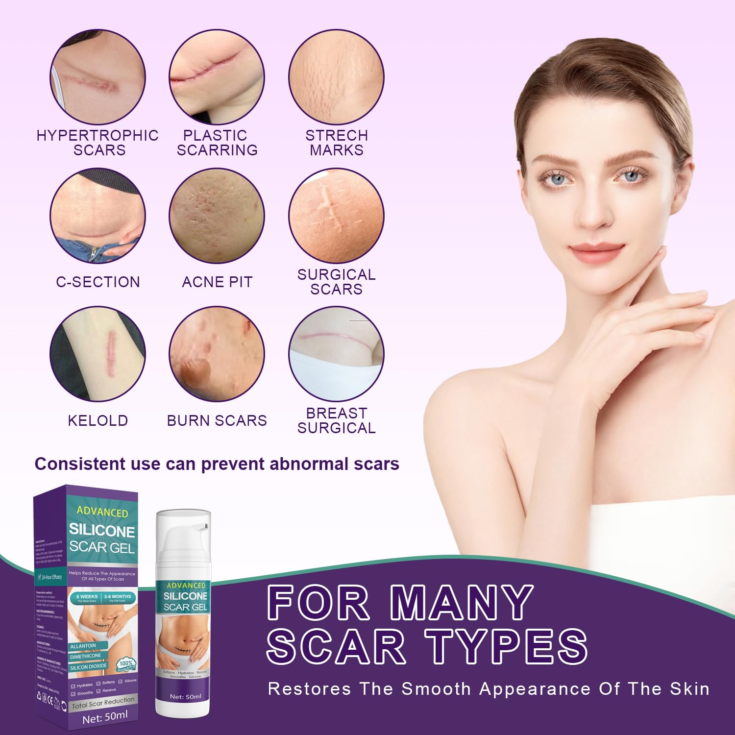 Tearich scar cream near a keloid-prone area offers gentle care