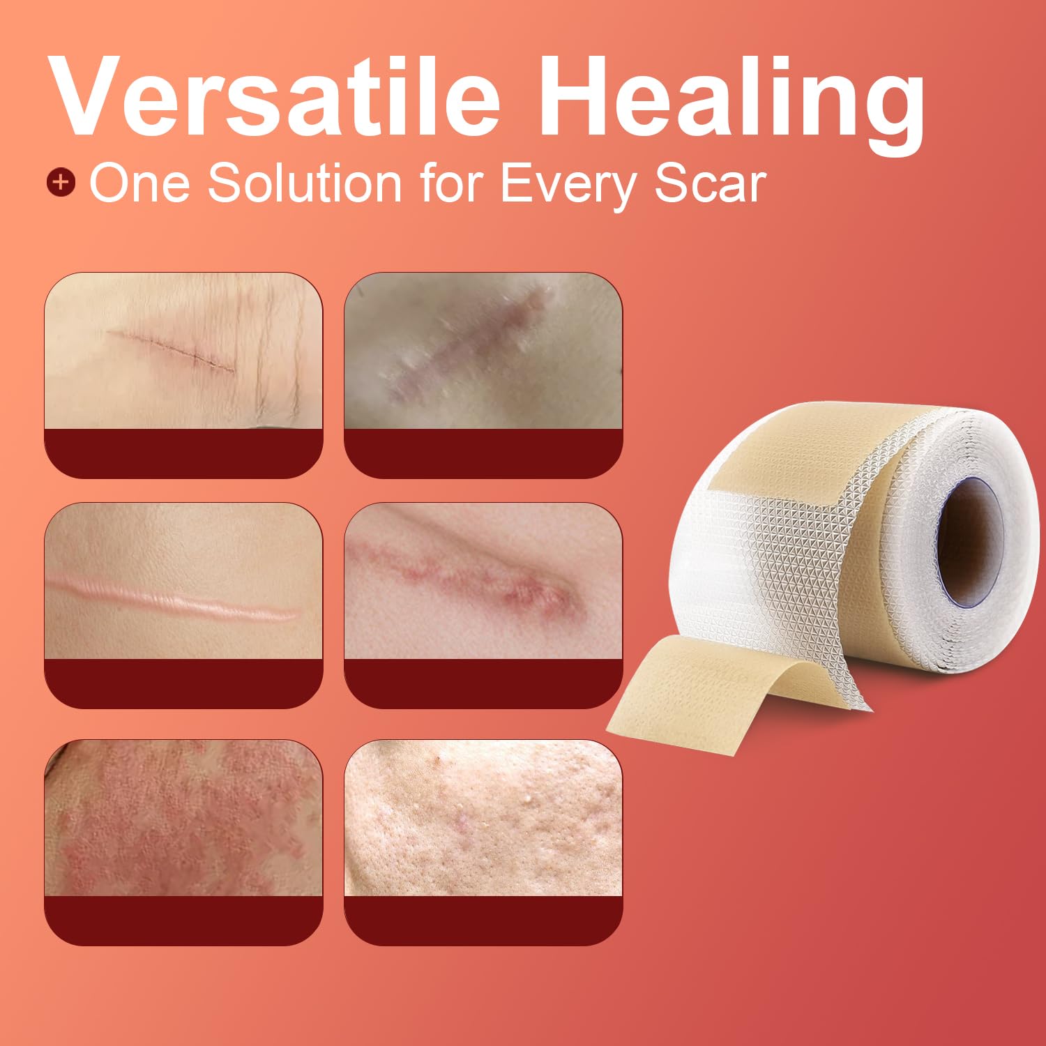 Tearich silicone scar tape applied to a C-section scar.