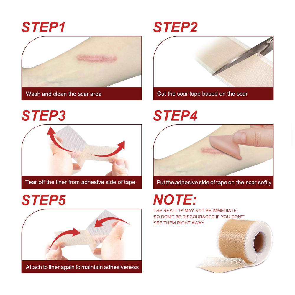 Tearich silicone scar tape reusable and cost-effective for ongoing care.