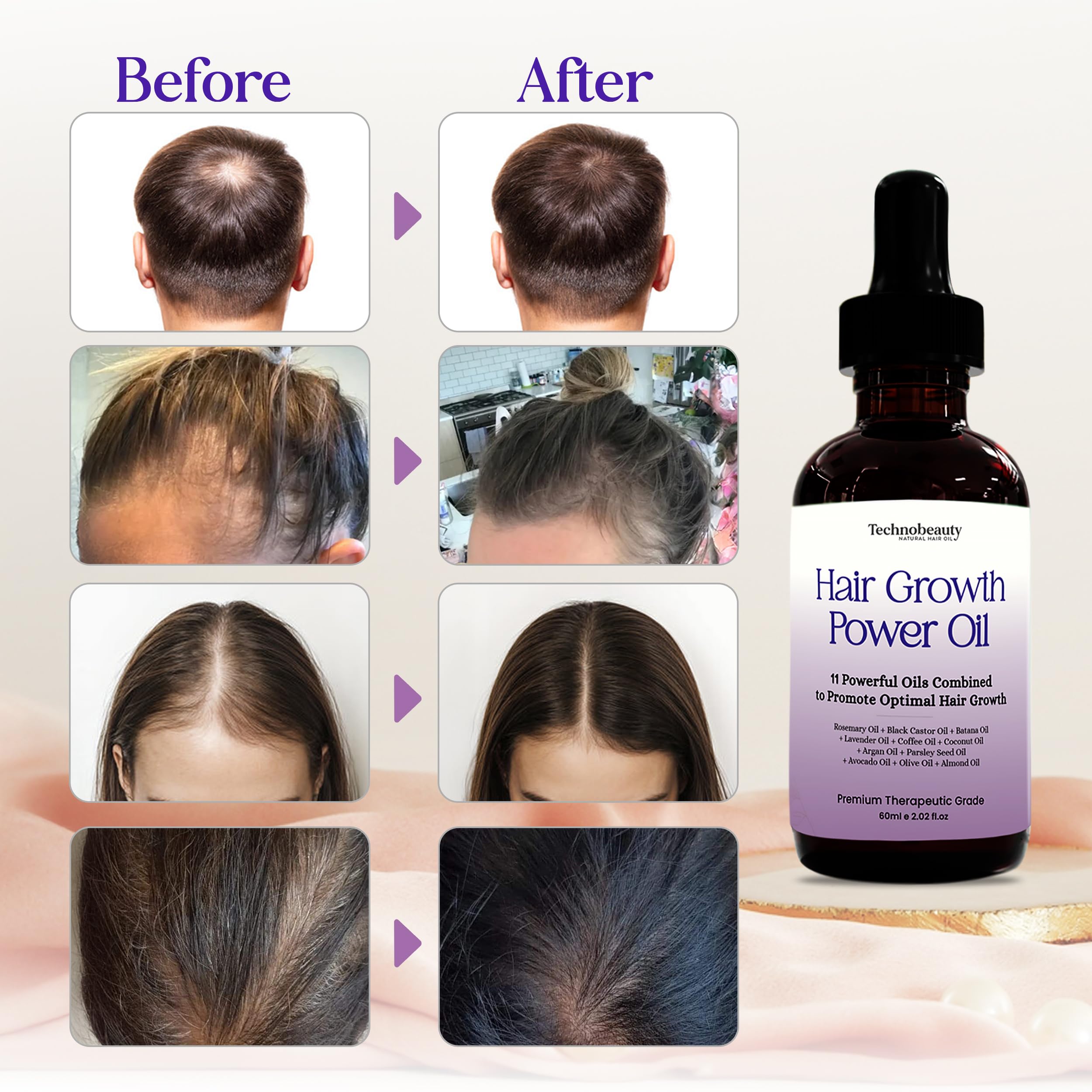 Technobeauty batana oil bottle hydrates hair and protects from damage