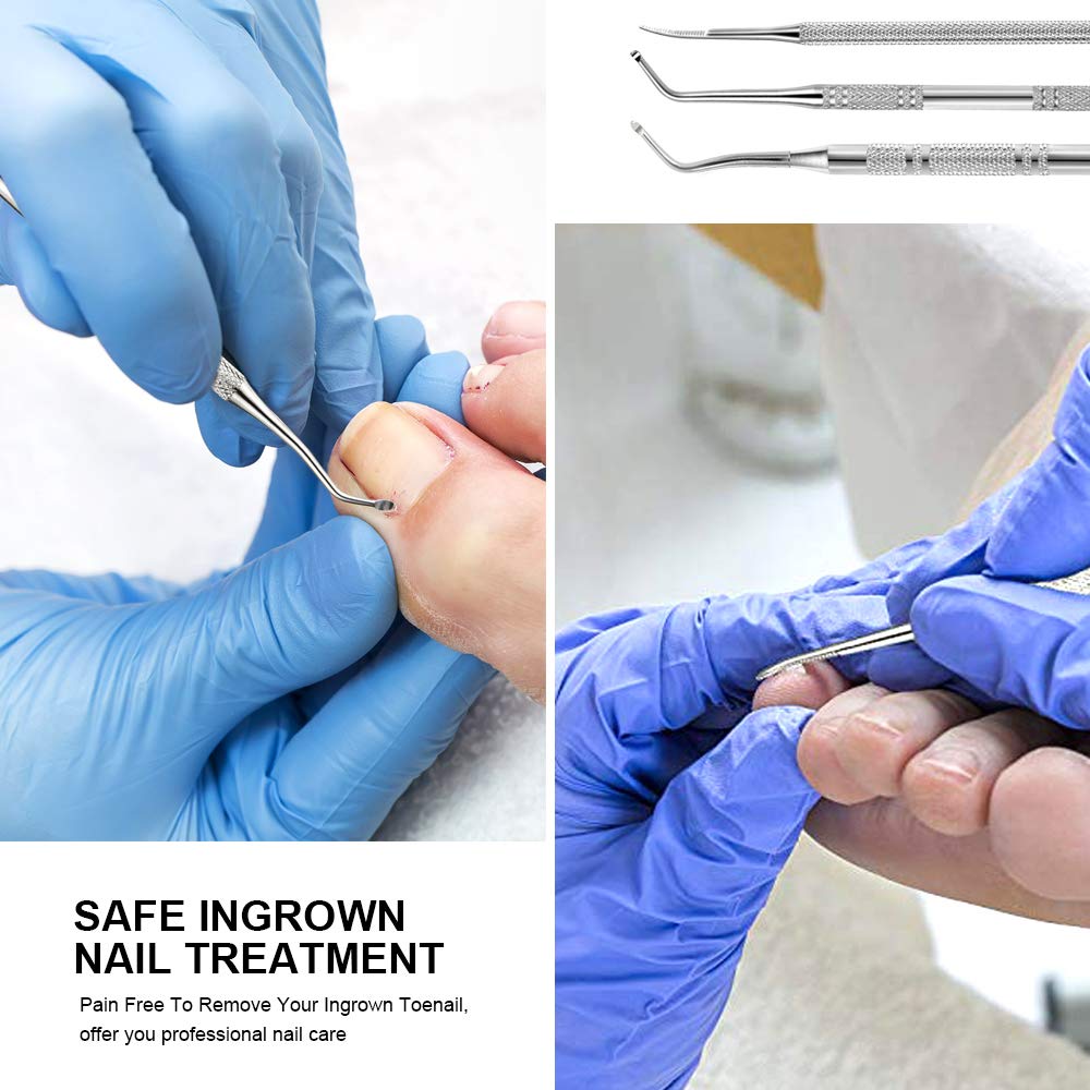 Teenitor home ingrown-nail care kit ready for quick DIY maintenance.