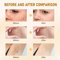 Teqnizo Bee Venom Cream application massage demonstrates gentle circular motions.