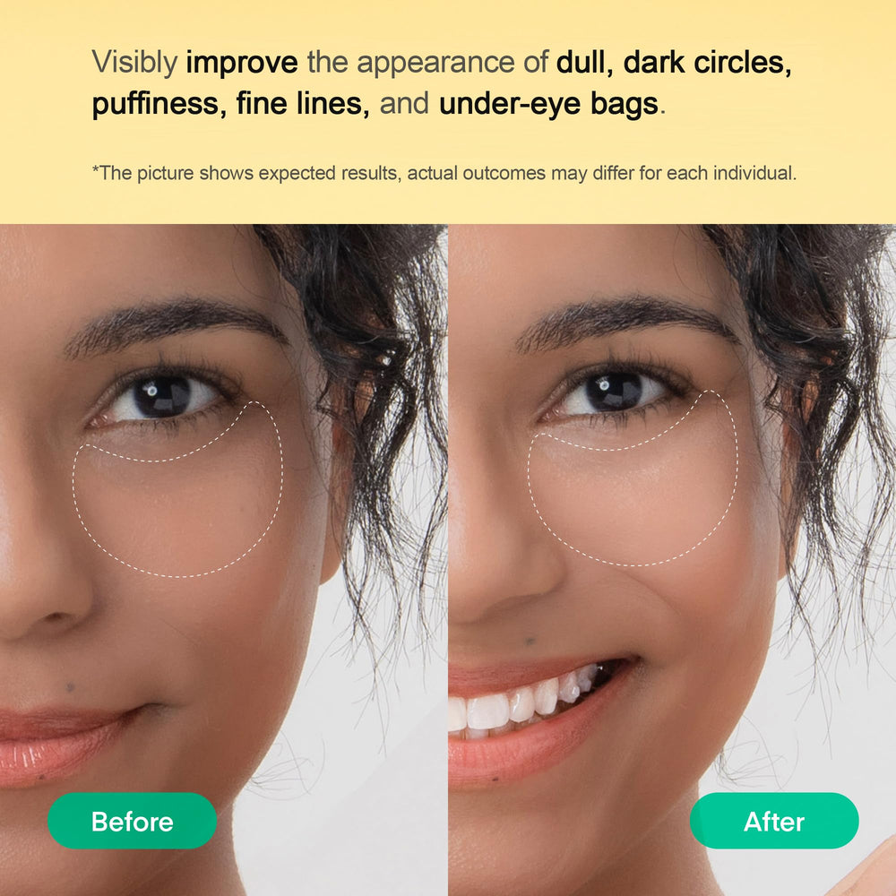 TEREZ & HONOR tranexamic acid action image illustrating dark circle targeting potential.
