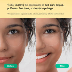 TEREZ & HONOR tranexamic acid action image illustrating dark circle targeting potential.