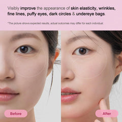 TEREZ & HONOR patch swatch on under-eye area showing cooling, refreshing feel.