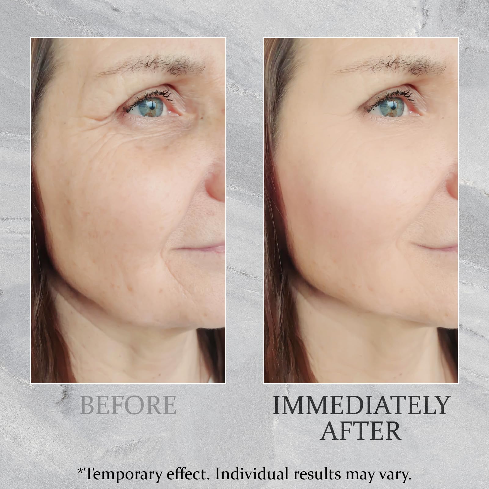 TEULN Anti-Aging Cream porcelain skin display with refined finish.