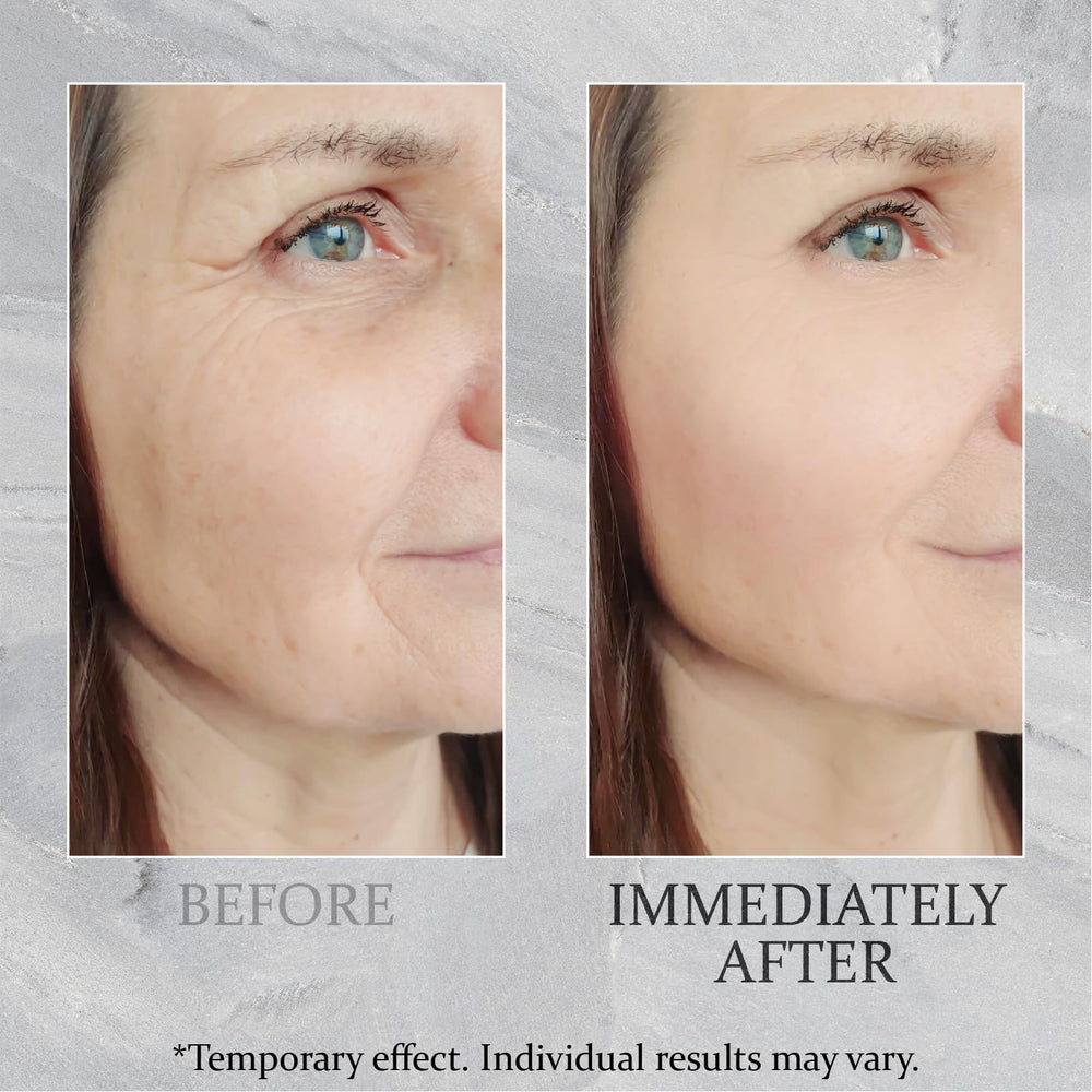 TEULN Anti-Aging Cream porcelain skin display with refined finish.