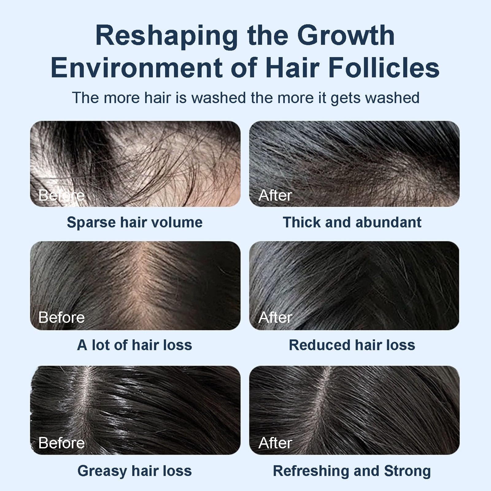 Tgideas dandruff-control shampoo bottle for balanced scalp care