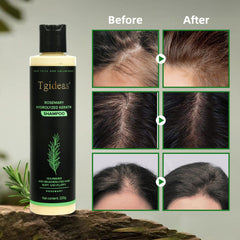 Fresh rosemary leaves hint at natural scalp nourishment