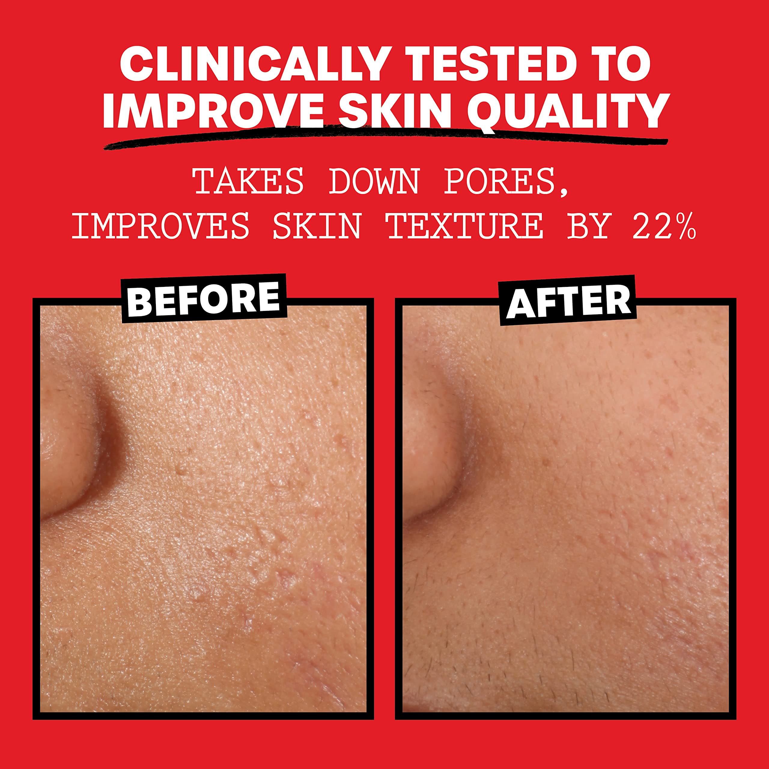 THAYERS Alcohol-Free Toner pack indicates non-drying, daily use.